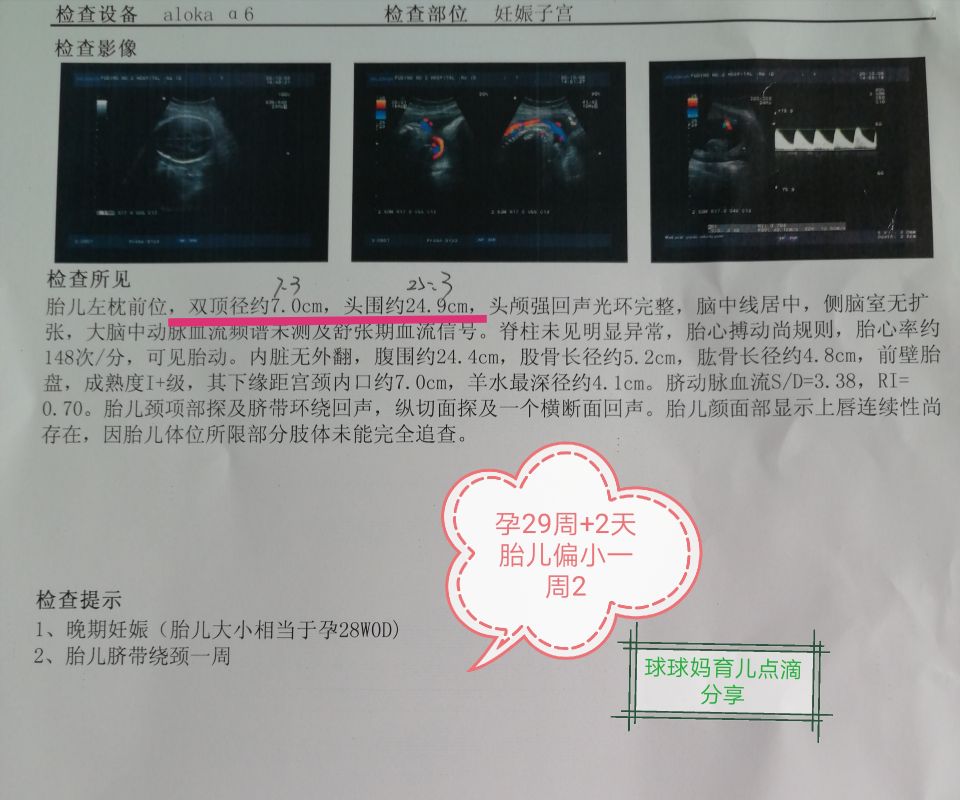 孕九周孕囊偏小血糖稍高怎么回事,怀孕29周孕检b超