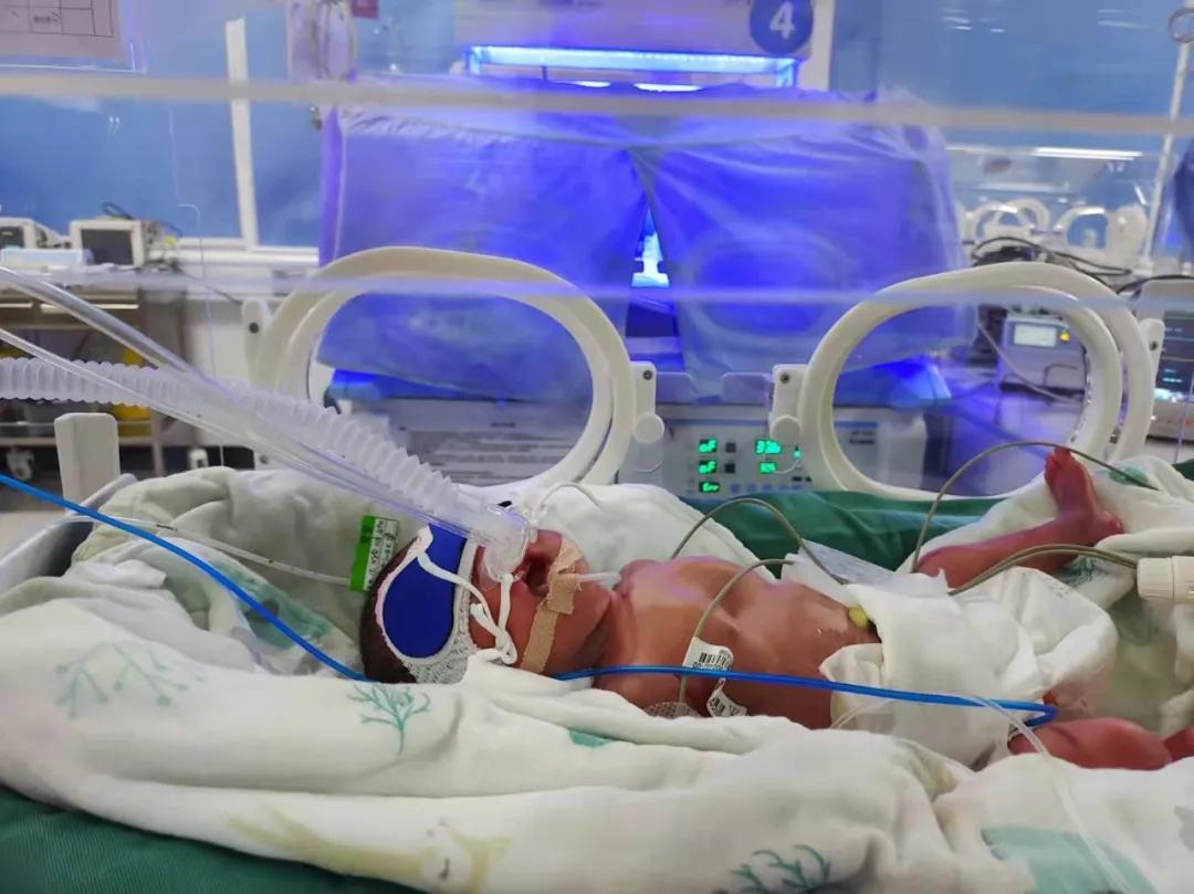 与生命赛跑重症转运全记录,生命接力危重症婴儿