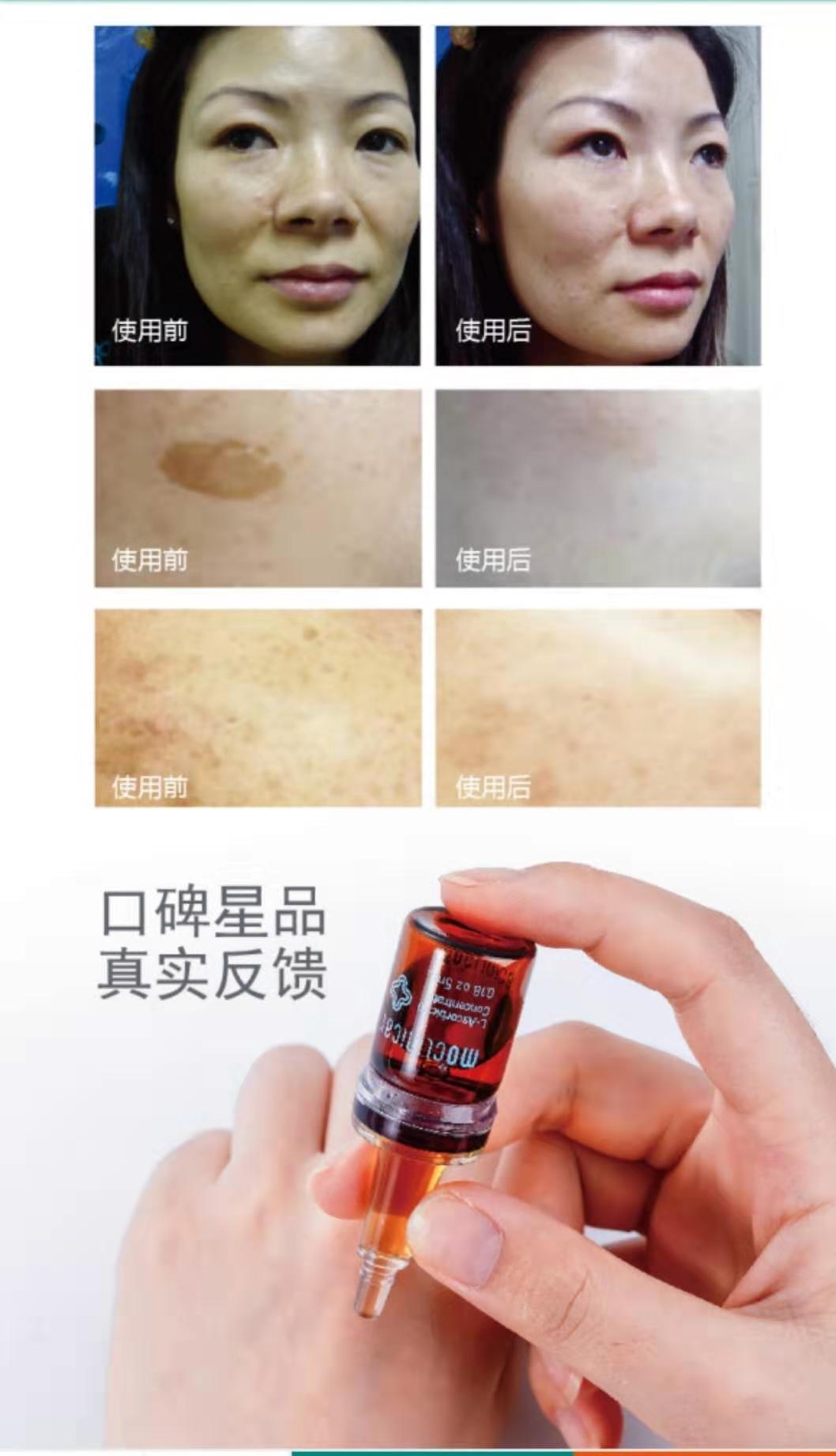 网红推荐的美白精华,网红精华液美白