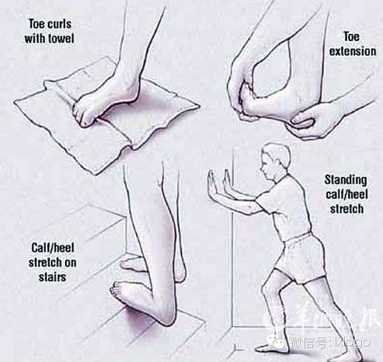 认识足底筋膜炎如何预防和康复,跑者如何正确对待足底筋膜炎