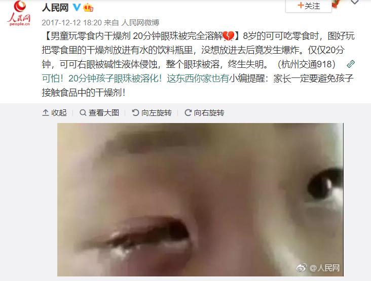 8岁男孩吹干燥剂眼球溶解了,小孩玩干燥剂眼睛被溶掉的图片
