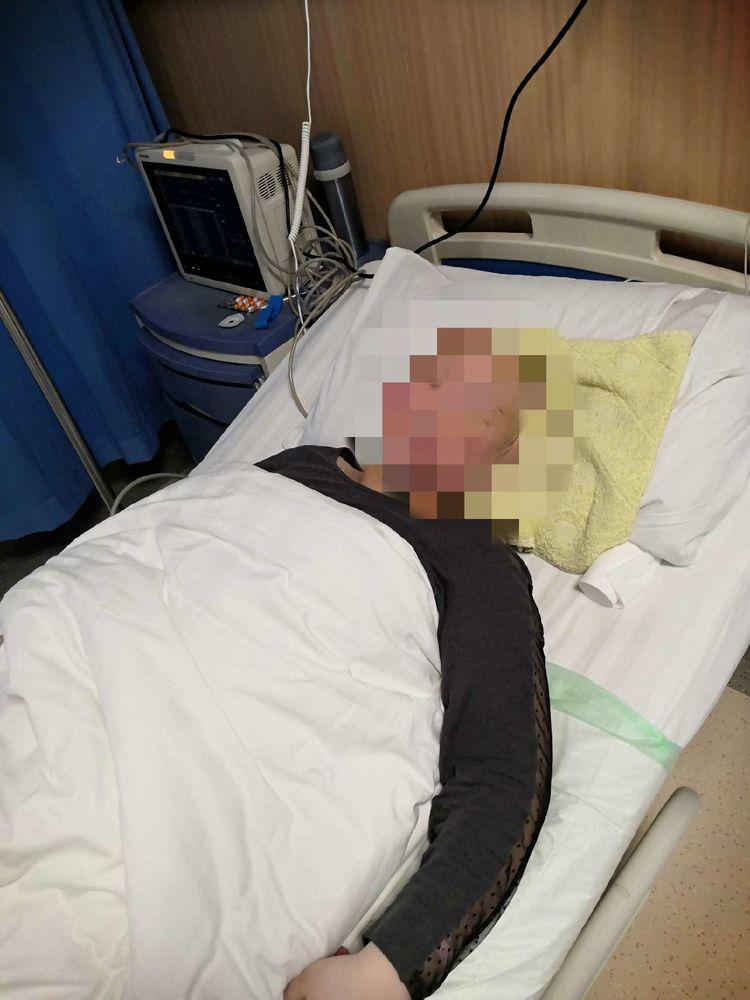 太原市中心医院MDT精诚合作完成腹腔镜下子宫瘢痕部位病灶切除术