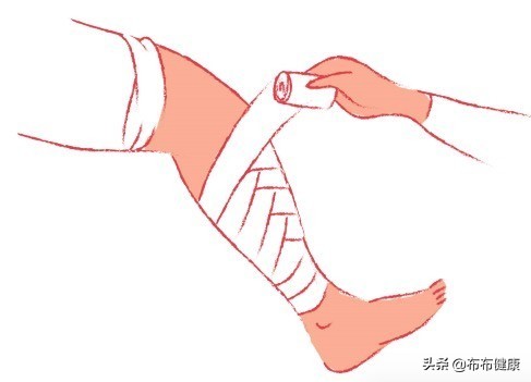 专家级指导：外伤后如何包扎伤口