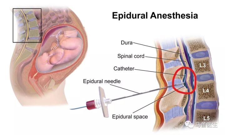 孕期安全使用的药,孕期安全用药一览表最新