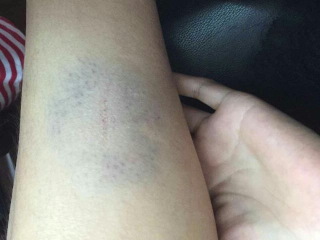 腿部突然出现问题,腿部出现异常信号