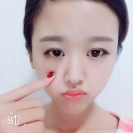 眼睛下面的泪沟怎么去,眼睛下的泪沟怎么去除