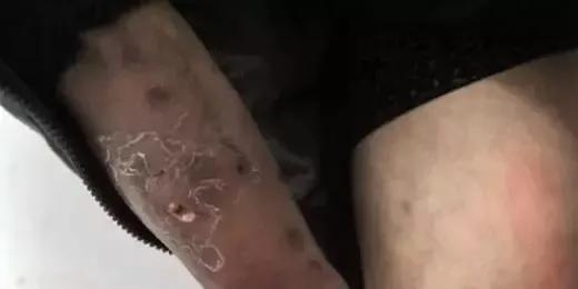 吸毒危害的科普小知识,吸毒太可怕请珍爱生命远离毒品