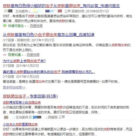 100人里就有20人中招，清洁不到位导致脸上冒虫，毛孔需要早清洁