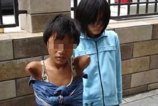 眼球被挖了还能接回去吗,眼球被挖掉了还能恢复么