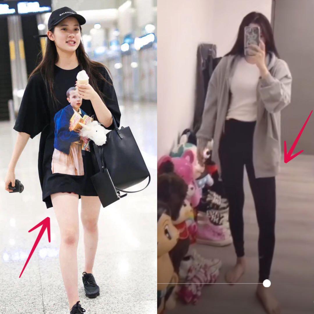 女子花8万做抽脂减肥,女子花68万做十次抽脂术