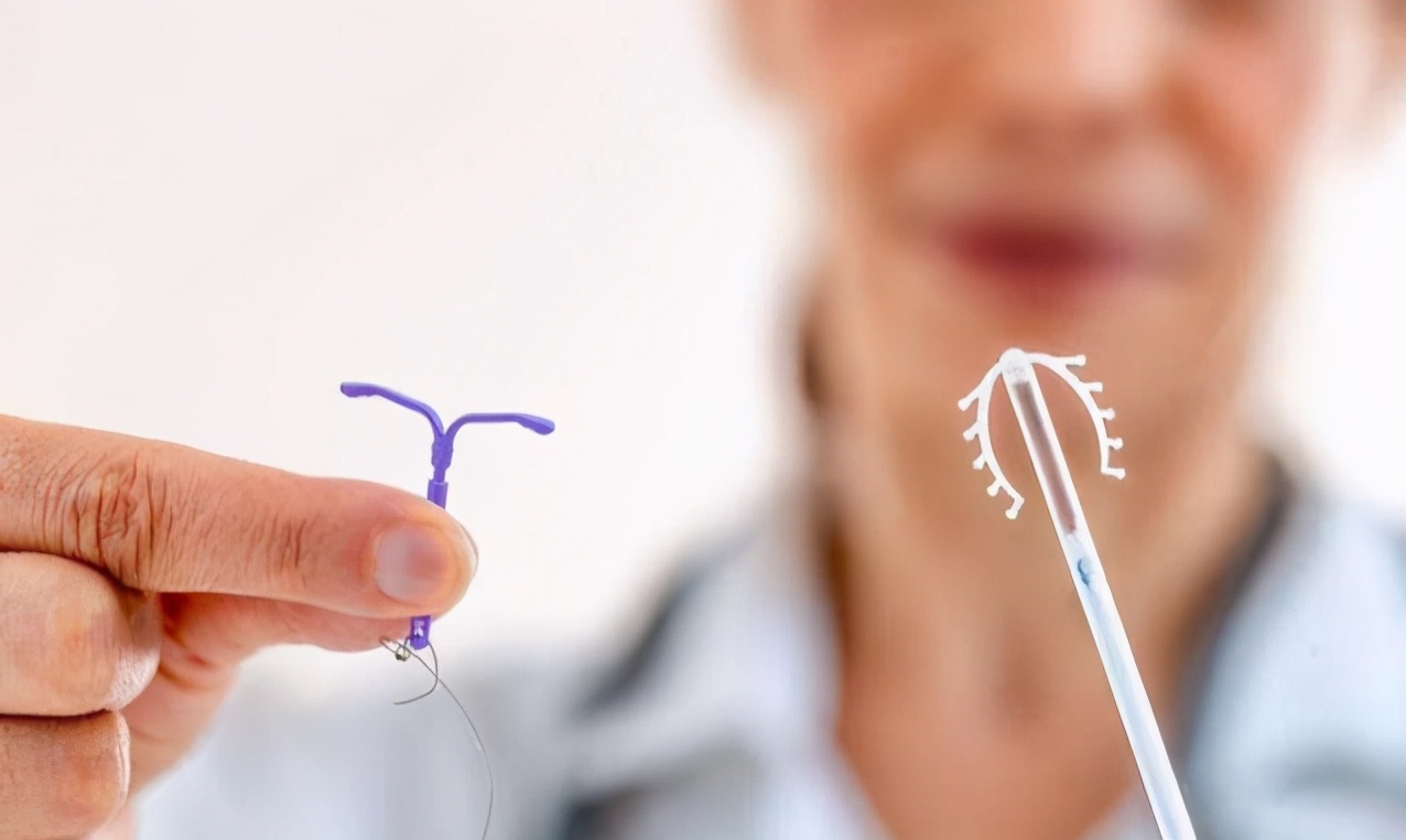 节育环取环后会出现什么现象,带环16年取环后不孕的原因