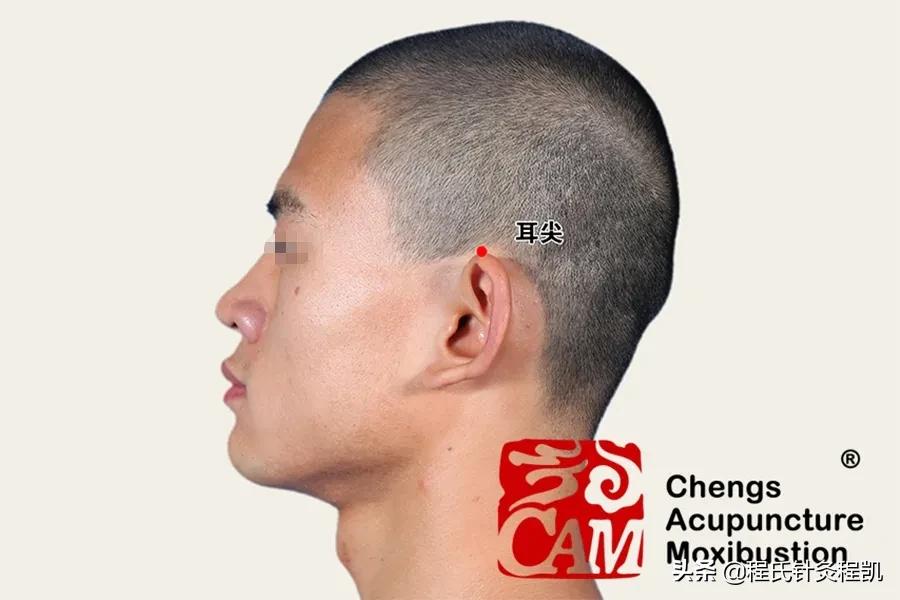 程凯养生说如何预防脑梗复发,程凯医生讲养生视频