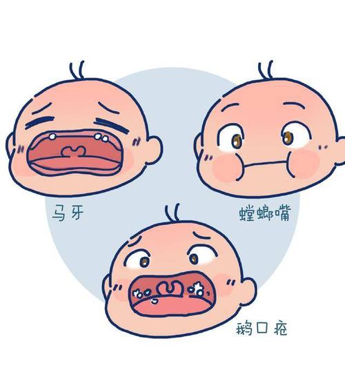 宝宝体重太轻怎么办,宝宝体重减轻不长肉