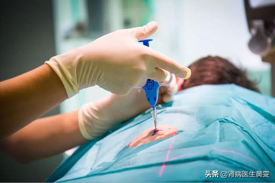 肾穿刺科普视频,关于肾部肿瘤穿刺活检