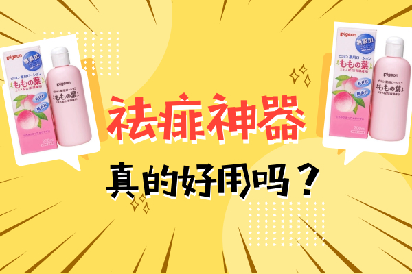 宝宝祛痱止痒喷雾测评,祛痱止痒推荐