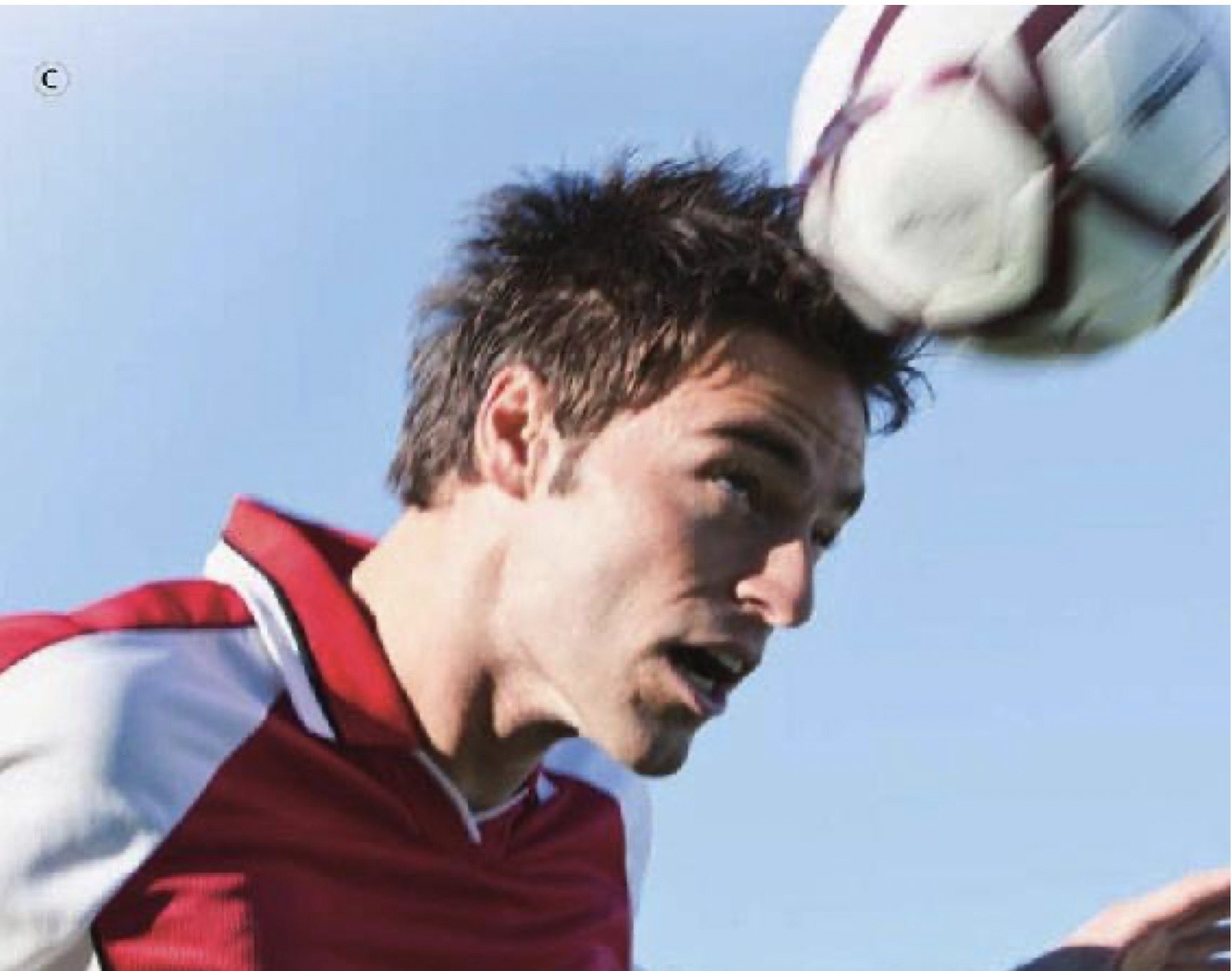 用头撞墙会脑震荡吗,拖鞋打头顶会打成脑震荡吗