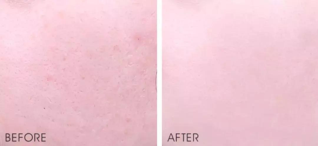 大创美白精华和雪肌精哪个好,大创美白精华