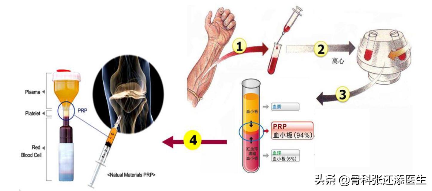 治疗膝关节痛的特效药氨糖,膝关节疼痛特效药偏方视频