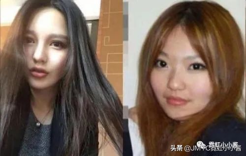 鼻子怎么修复好看呢,鼻型修复方法大全