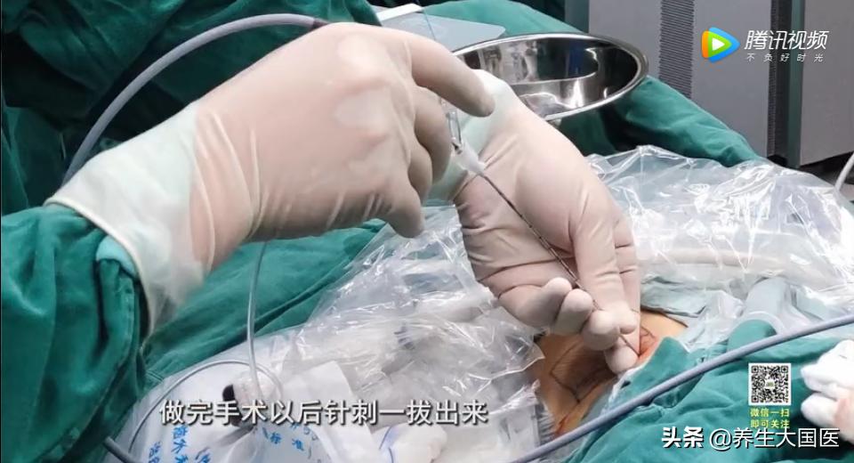 身体长石头是什么意思,人体老是长石头怎么回事