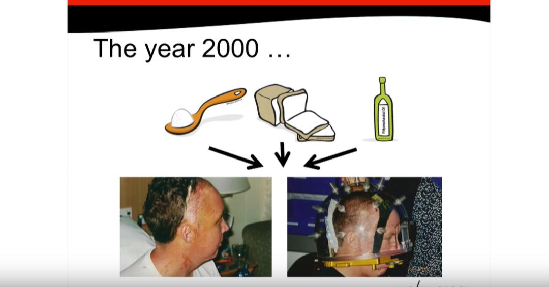 炎症会导致癌症爆发？如何缓解炎症和拯救癌症？