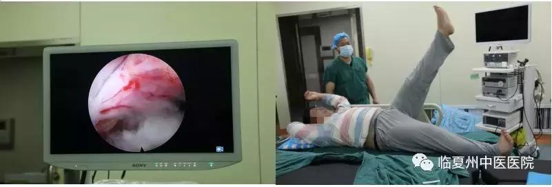 临夏州腰椎间盘突出微创手术,甘肃省中医院脊柱科微创手术