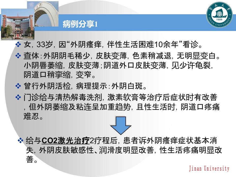 外阴白斑怎么治疗可以激光治疗吗,外阴白斑怎么治疗大概花多少钱