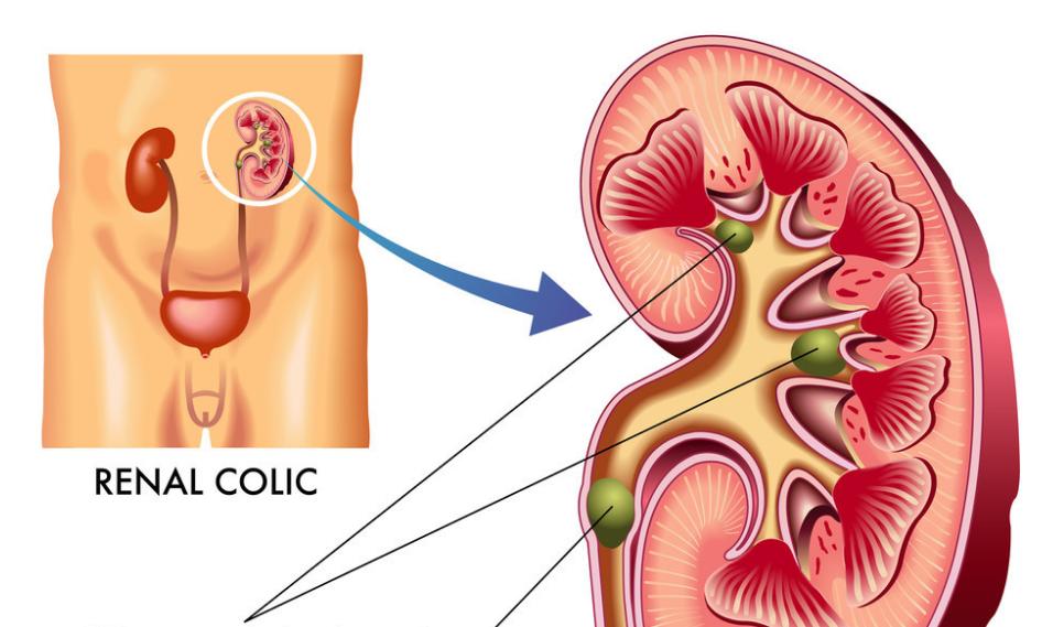 男人常腰痛,男人睡到半夜四点腰痛是不是肾虚