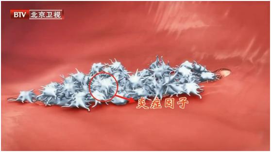 这些炎症可能比癌症更可怕，发病快、致死率高！用好餐桌上的“天然消炎剂”，给身体“消消炎”