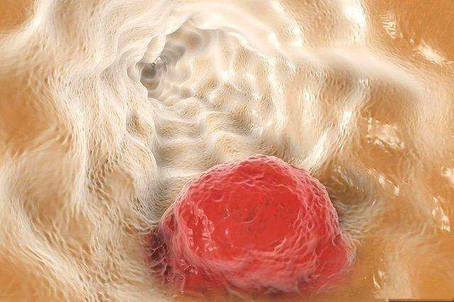 张春荣癌症专家,张春荣教授有治愈癌症的案例吗