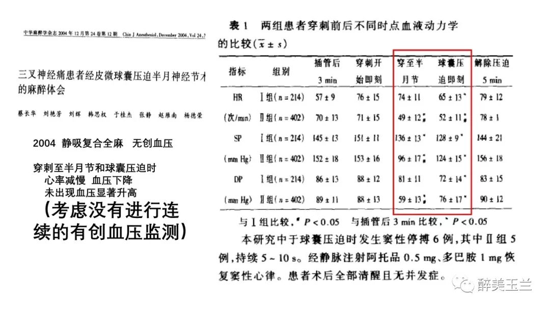 病例分享丨三叉神经节微球囊压迫术的麻醉管理