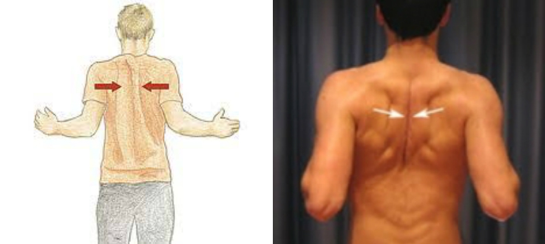 怎么改善硬拉,罗马尼亚硬拉为什么腰酸背痛