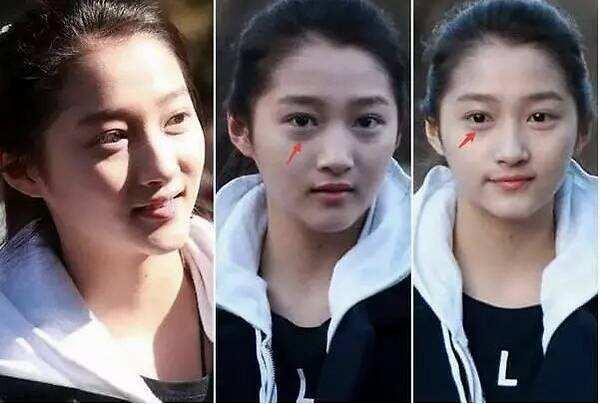 眼袋跟卧蚕的区别对比图,眼袋和卧蚕和黑眼圈的区别的图片