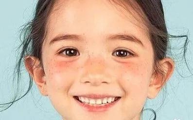 脸部长斑是什么原因,脸部长斑是什么原因导致的