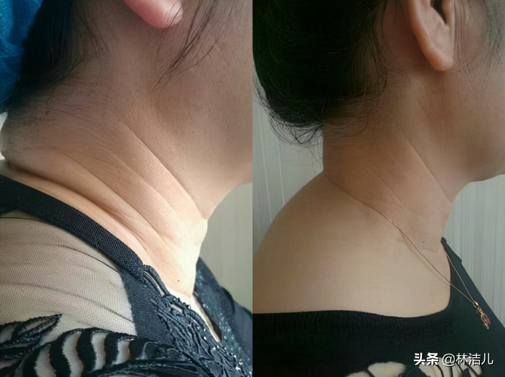 宋祖儿赵露思面部折叠度,宋祖儿赵露思年纪