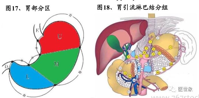 nccn指南胃癌的治疗方案,csco胃癌诊疗指南2023
