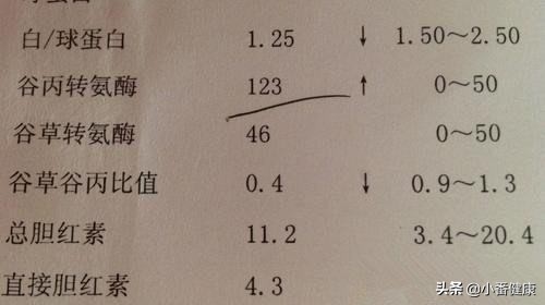 乙肝大三阳肝功能转氨酶高怎么办,感冒会引起谷丙转氨酶高