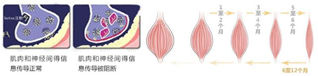 打完瘦脸针几天可以敷面膜,瘦脸针打完后几天出效果