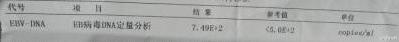 儿童eb病毒感染肝受损严重吗,EB病毒感染是什么