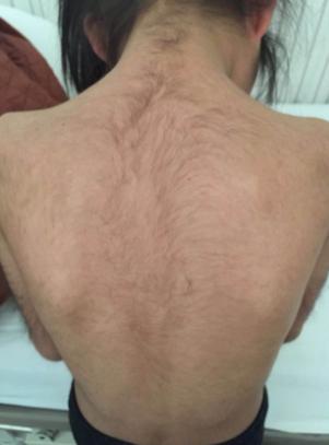 王大妈儿媳妇花了1W脱毛后才明白,千万不要轻易去脱毛