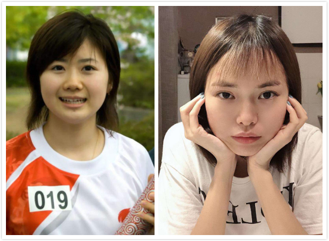 怎么判断脸是不是脂肪脸,怎么判断自己的脸是不是油脸