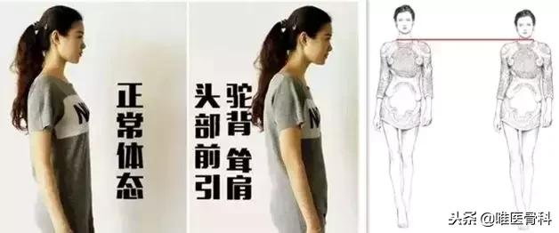 中央二台乌龟颈矫正训练,针对自己的乌龟颈怎么矫正