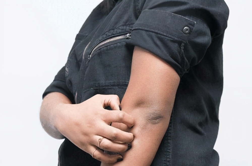 皮肤病血液有问题怎么办,皮肤病积血什么问题