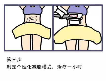 酷塑冷冻溶脂副作用是什么样的,酷塑冷冻溶脂的真实经历对比