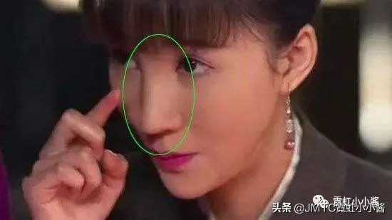 鼻子怎么修复好看呢,鼻型修复方法大全