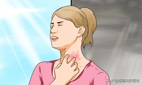 体癣衣物怎么消毒,体癣反复发作怎么回事