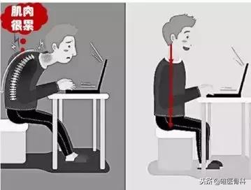 中央二台乌龟颈矫正训练,针对自己的乌龟颈怎么矫正