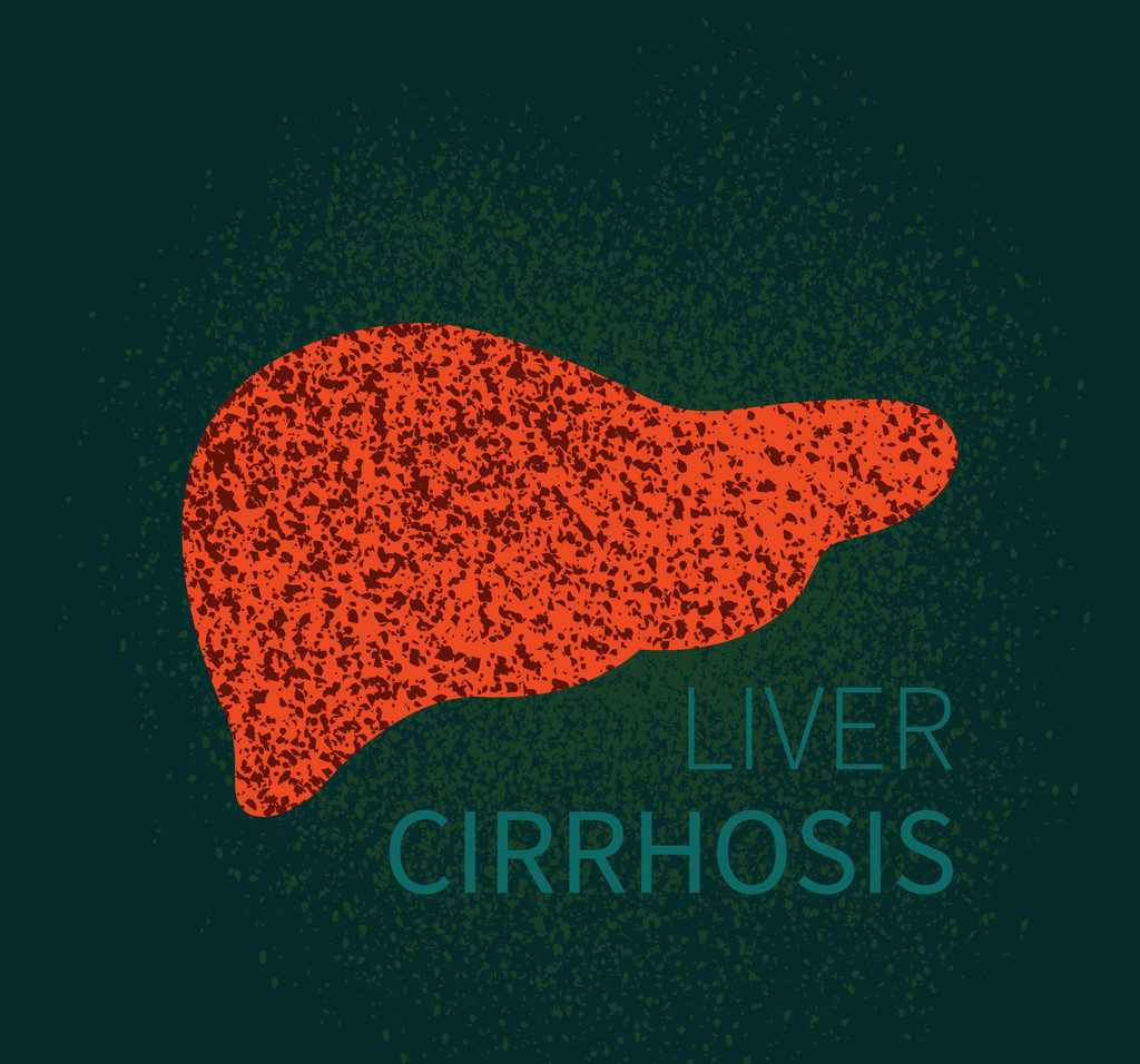 抗病毒后进展为肝硬化的几率大吗,抗病毒治疗后乙肝有传染性么