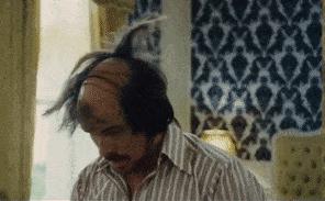 体毛可以移植么,体毛移植到头顶可行吗