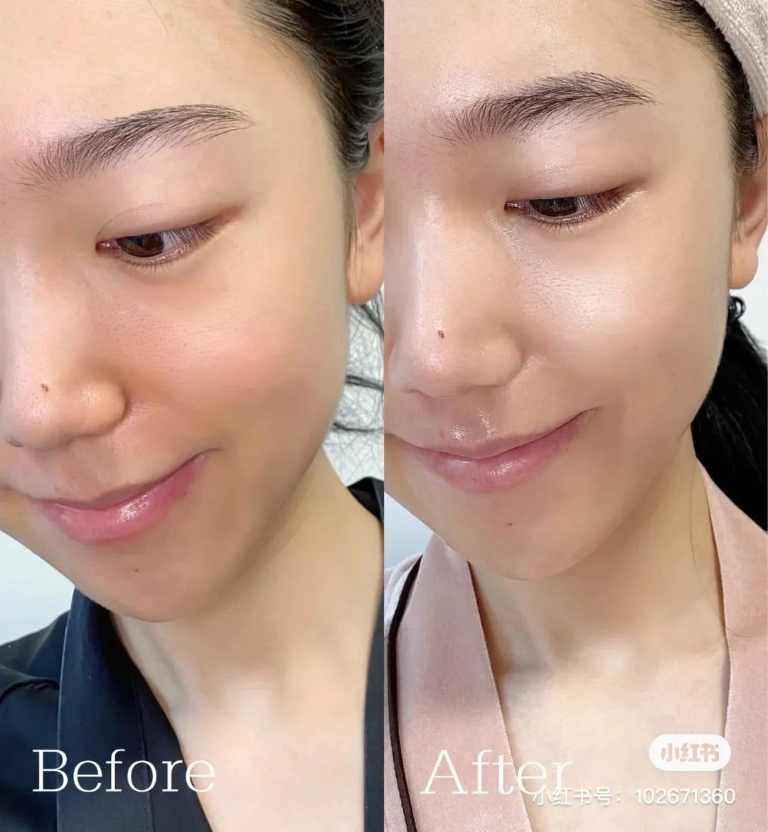 小玛急救水修护霜,小玛急救水值得入手吗